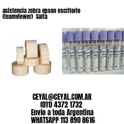 asistencia zebra epson escritorio (teamviewer)  Salta